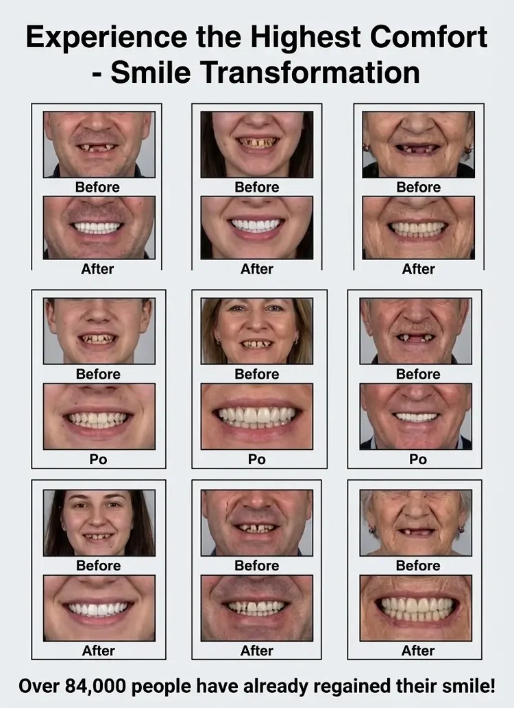 🏆Ends Today: 50% OFF! 🏆2026 Bestselling Product🦷 Fit for a Fresh Smile, Say Goodbye to Wearing Discomfort!