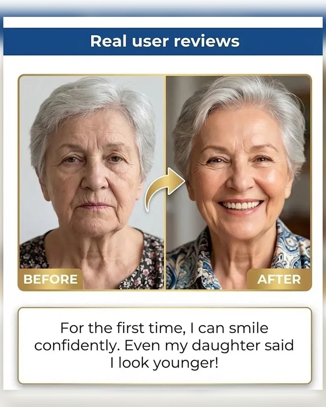 🏆Ends Today: 50% OFF! 🏆2026 Bestselling Product🦷 Fit for a Fresh Smile, Say Goodbye to Wearing Discomfort!